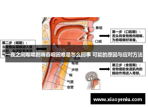 一夜之间喉咙剧痛吞咽困难是怎么回事 可能的原因与应对方法